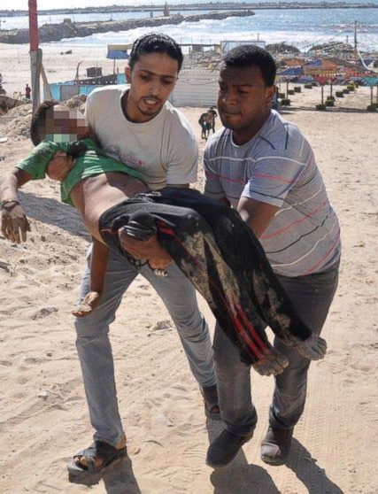 RT_gaza_bombing_child_jtm_140716_16x9_992