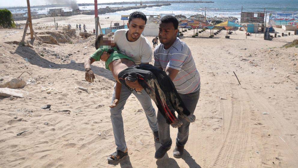 RT_gaza_bombing_child_jtm_140716_16x9_992