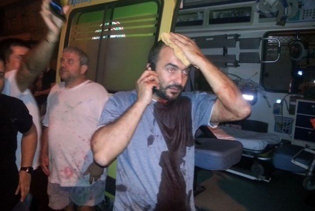 Ο πρόεδρος του Συνδικάτου Μετάλλου, Σωτήρης Πουλικόγιαννης, χτυπημένος στο κεφάλι μετά τη δολοφονική επίθεση της Χρυσής Αυγής στους συνδικαλιστές του ΠΑΜΕ στο Πέραμα
