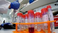 vaccine_embolio_ap_image