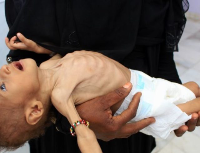 yemen-child