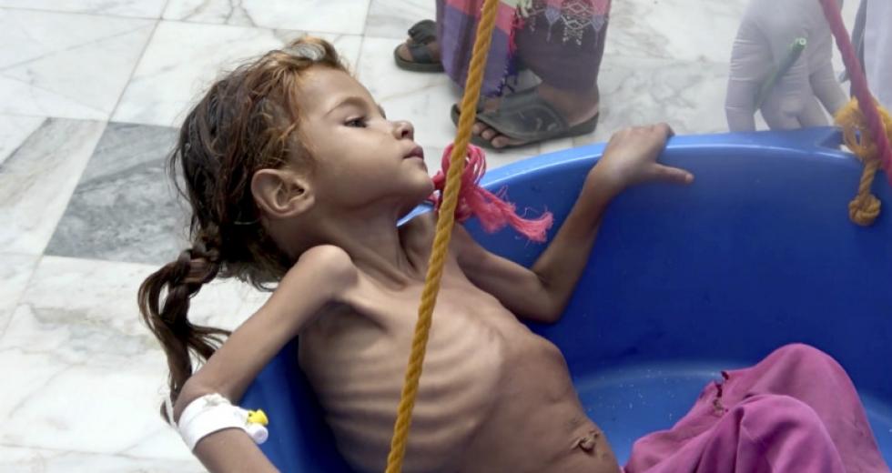 yemen-paidi-peina