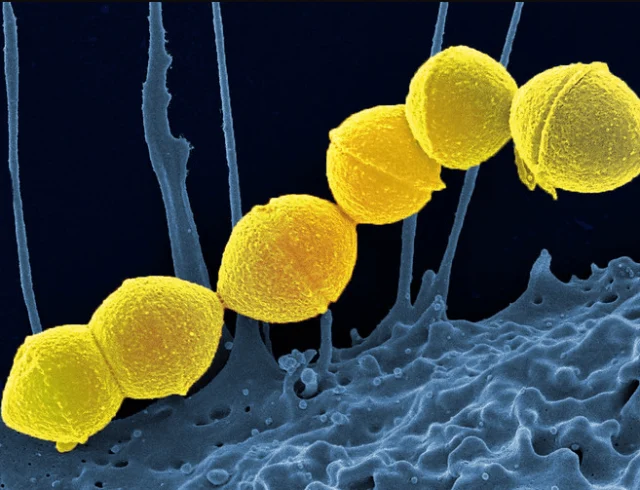 streptococus