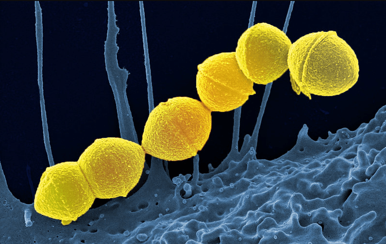 streptococus