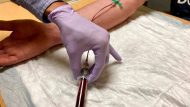 Cancer Blood Test