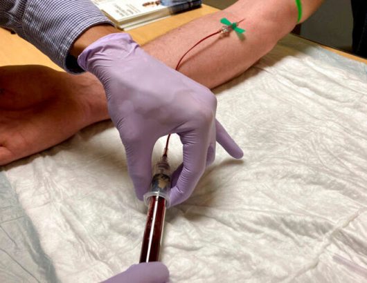 Cancer Blood Test