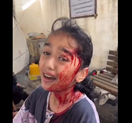 gaza-girl_hospital