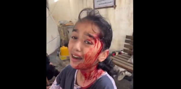 gaza-girl_hospital