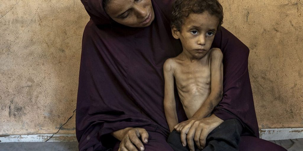 ce7f5042469e0a63d73dc0471d376a59_GAZA-STARVATION-4-1-1080×1080