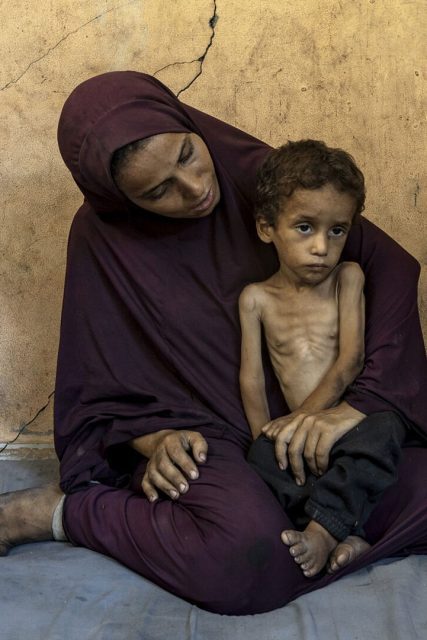ce7f5042469e0a63d73dc0471d376a59_GAZA-STARVATION-4-1-1080×1080