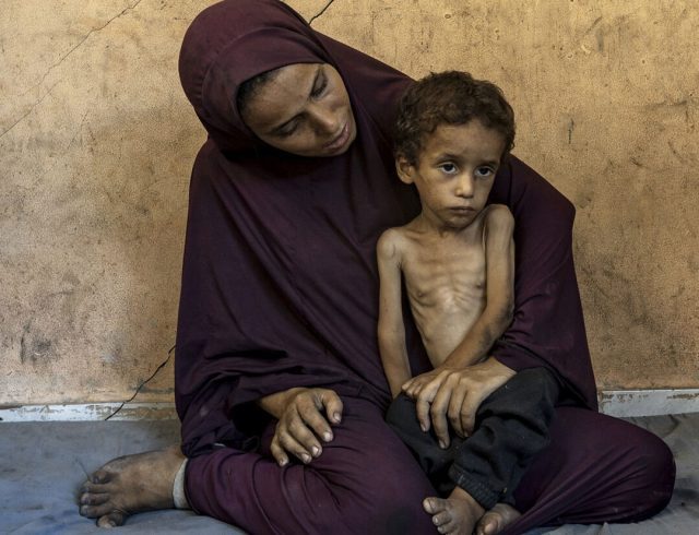 ce7f5042469e0a63d73dc0471d376a59_GAZA-STARVATION-4-1-1080×1080