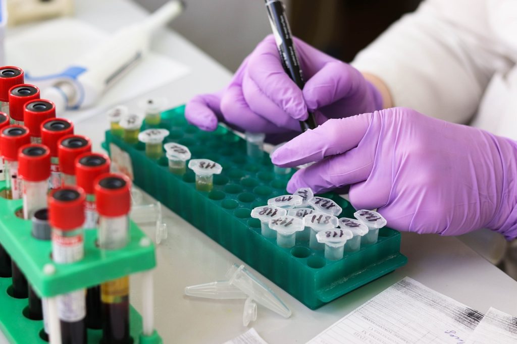 laboratory-3827745-1280-1024×682
