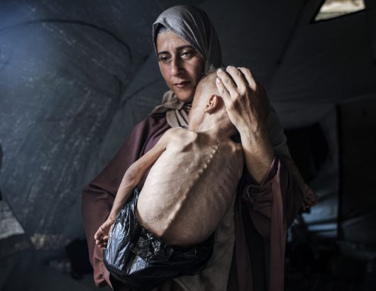 gaza-ypisitismeno-paidi