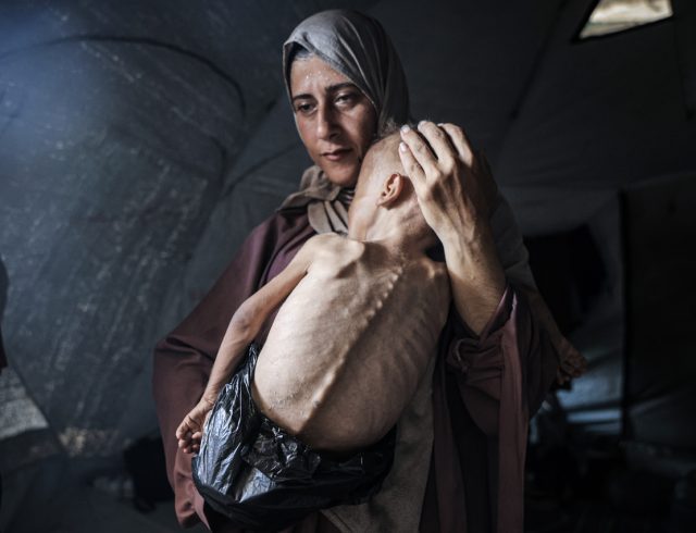 gaza-ypisitismeno-paidi