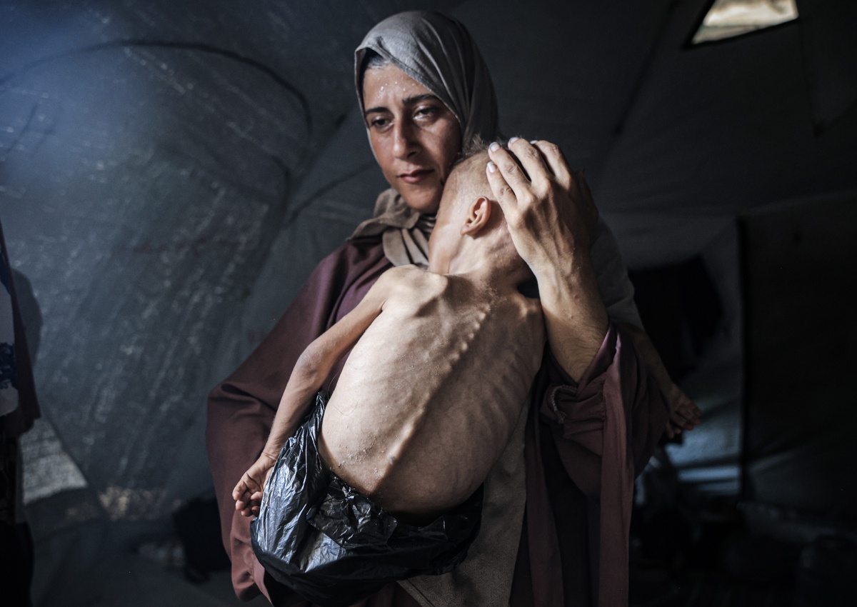 gaza-ypisitismeno-paidi