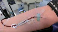 Blood_plasma_donation_3653