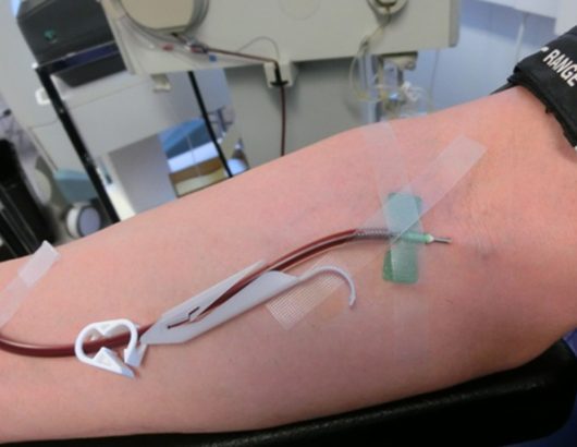 Blood_plasma_donation_3653