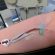 Blood_plasma_donation_3653