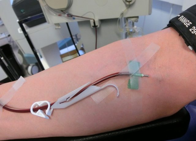 Blood_plasma_donation_3653