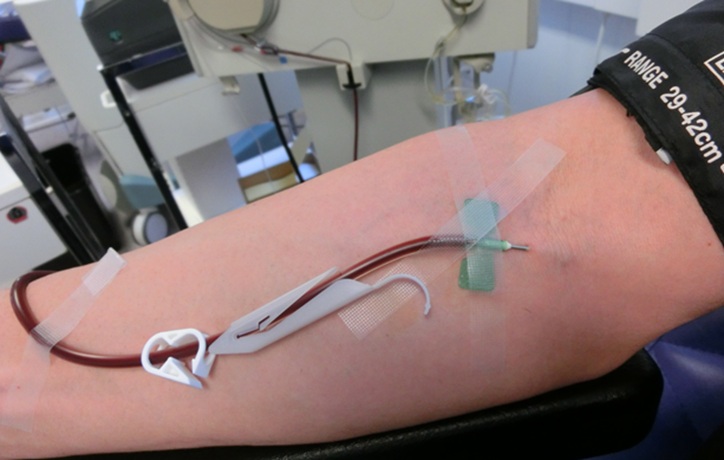 Blood_plasma_donation_3653